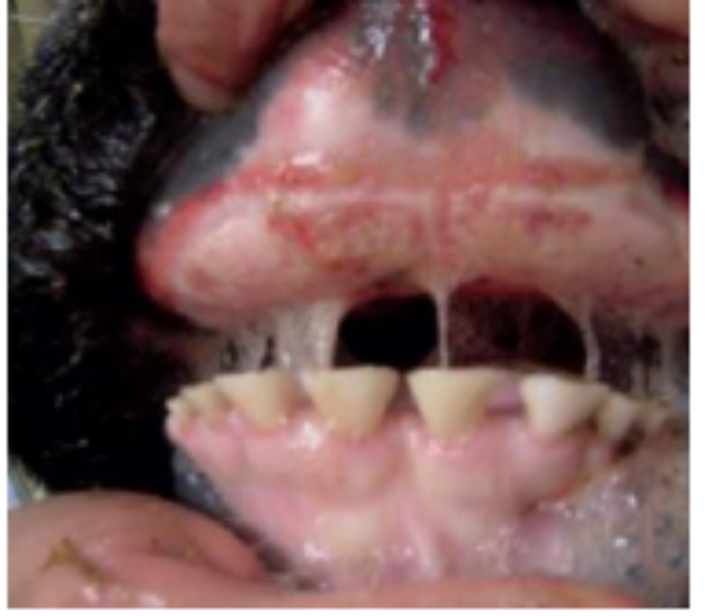 Blauzunge Symptome beim Rind