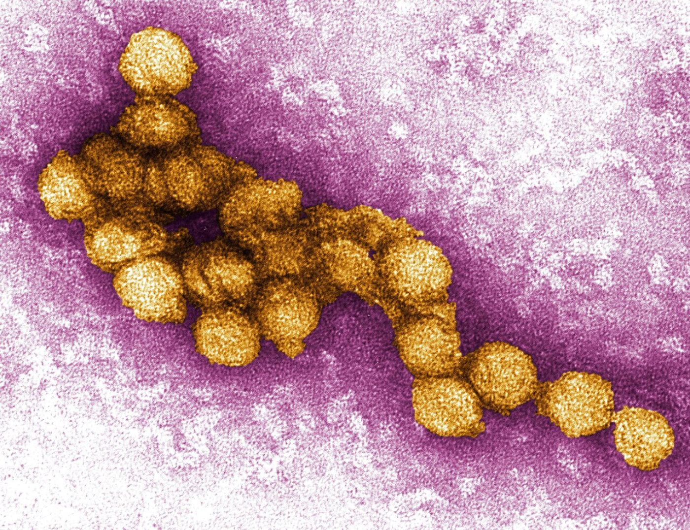 Micrograph eines West Nil Virus
